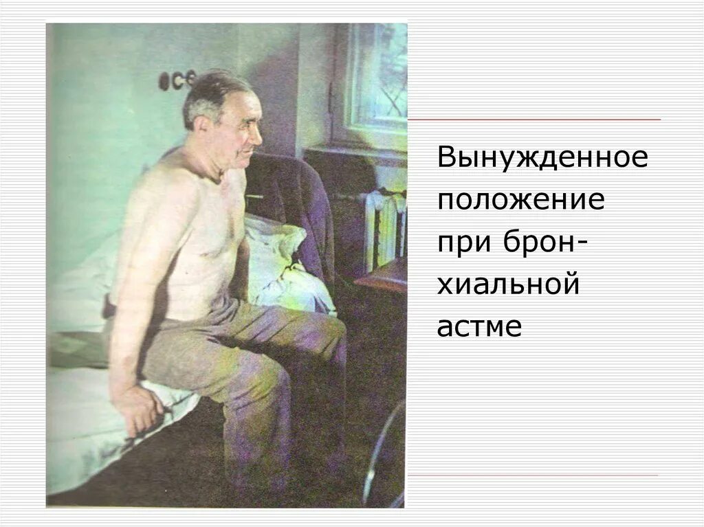 Положение при астме. Бронхиальная астма ортопноэ. вынужденное положение при бронхиальной астме. вынужденное положение при приступе бронхиальной астмы. поза ортопноэ при бронхиальной астме.