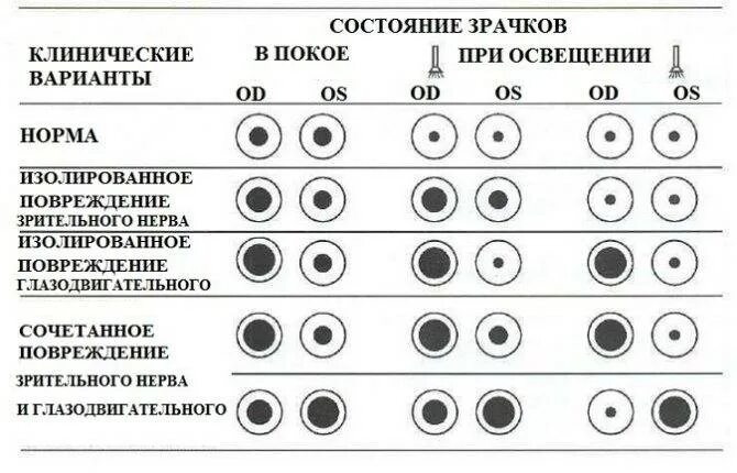 Зрачки и пульс проверить