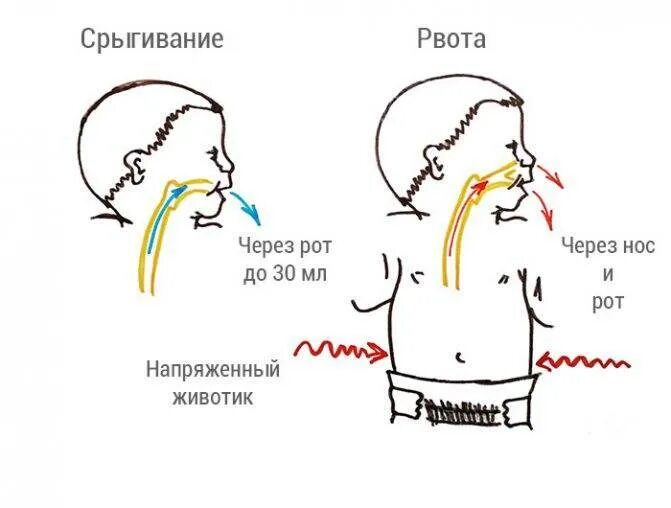 Почему часто блюешь. Почему новорожденный ребенок срыгивает. Профилактика срыгивания.