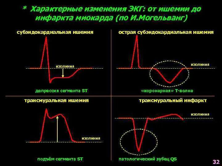 Типичные изменения