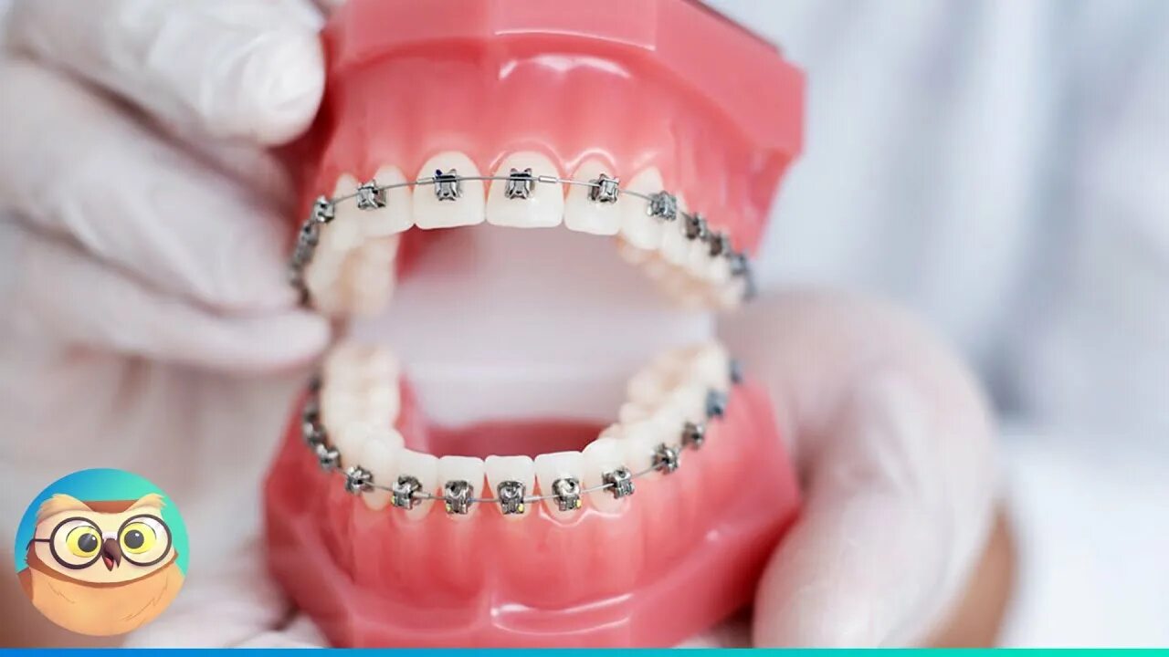 Crooked teeth? Have you considered #LingualBraces? ...the modern and invisible a