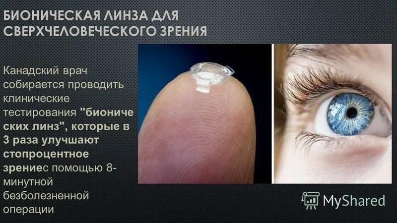 Биологическая линза глаза переходит в непрозрачную. Биологическая линза глаза переходит в непрозрачную. Контактные линзы. Биологическая линза глаза переходит в непрозрачную. Биологическая линза глаза переходит в непрозрачную.