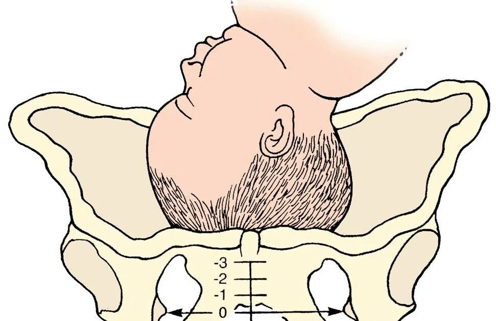 Лобковые кости таза. Лобковые кости при беременности. Тазовые кости при родах. 39 недель головка