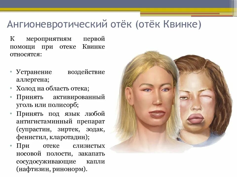 Аллергия на йоркширского терьера: симптомы, что делать?