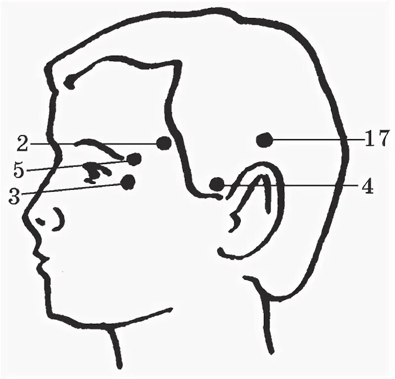 Болезненные точки на голове. Болезненные точки на висках. Висок у человека.