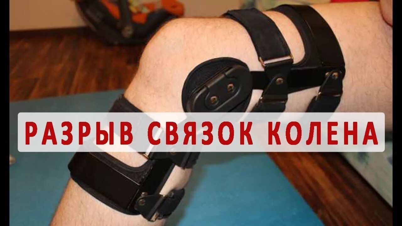 Разрыв связок колено как лечить. Разрыв крестообразной связки коленного сустава. частичный разрыв связок коленного сустава. разрыв связок колена лечение. повреждение связок коленного сустава латиный.