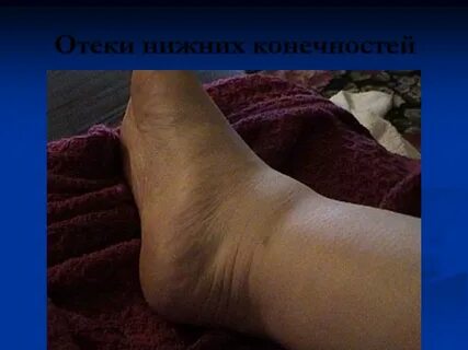 Болезнь жене