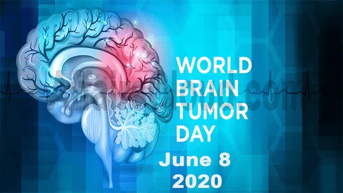 Brains day. Brain 2020. World Brain wells. World Brain Day. Ротвеллеры Мирой мозг.