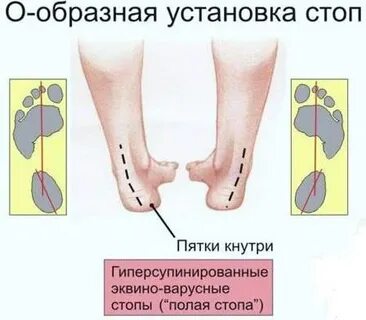 Установи на стоп