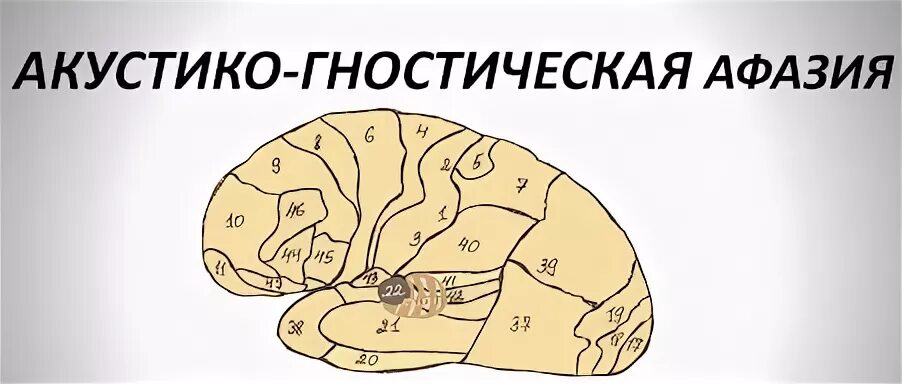 Акустико семантической афазии. Акустико семантической афазии