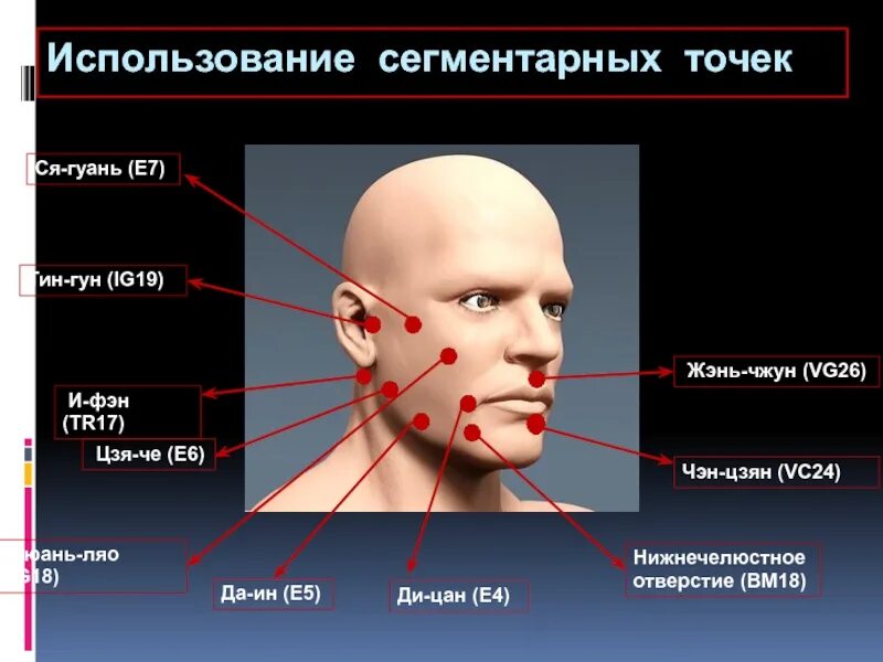 Контрактура мимических мышц. Контрактура лицевых мышц. Контрактура мимических мышц лица. Точка vg26.