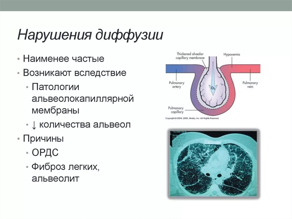 При диффузии газов в легких происходит. Нарушение диффузии. Нарушение диффузии легких. Причины нарушения диффузии. Нарушения диффузии схема.