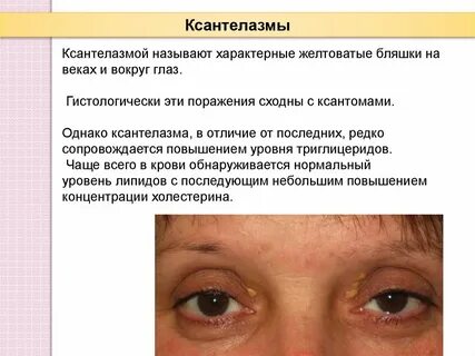 Признаки век