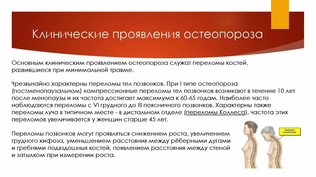 Клинические проявления остеопороза. Клинические симптомы остеопороза. Основные клинические проявления остеопороза. Клинические проявления остеопороза у женщин.