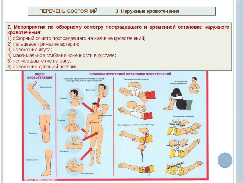 Мероприятия по временной остановке наружного кровотечения. Схема остановки кровотечения. Мероприятия по обзорному осмотру пострадавшего. Мероприятия по обзорному осмотру пострадавшего и временной.