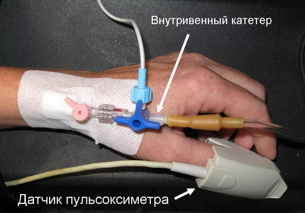 Как поставить систему