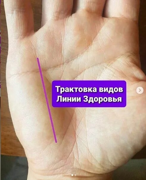 Расшифровка линии здоровья. Линия судьбы на руке. Линия ума. Линия головы. Линия здоровья на ладони.