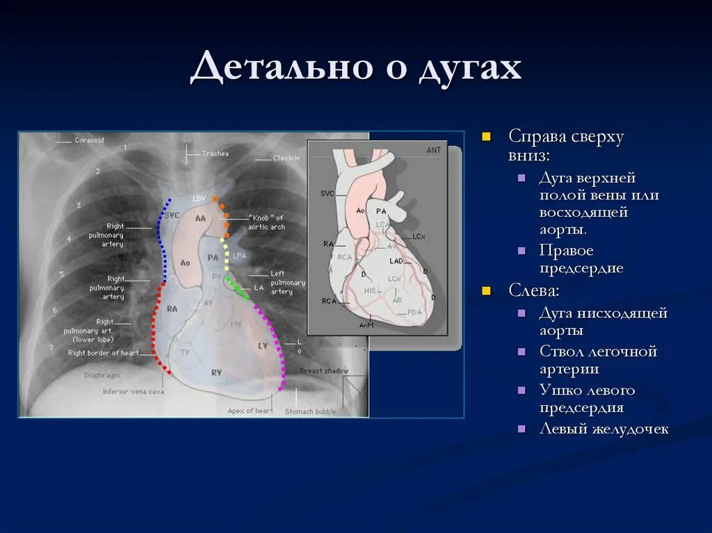 Дуга аорты анатомия рентген. Дуги сердца на рентгене норма. Аорта рентген норма. Строение сердца на рентгенограмме. Норма правого предсердия