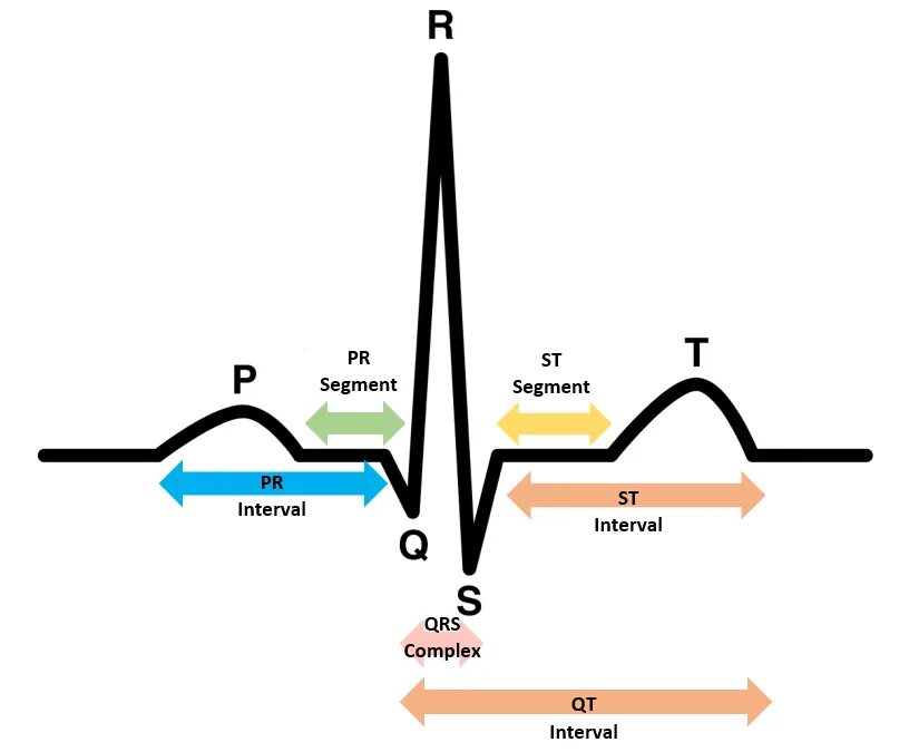 Удлинение комплекса qrs. P qrs t экг. qrs электрокардиограммы. комплекс qrs на экг. комплекс pqrst на экг.