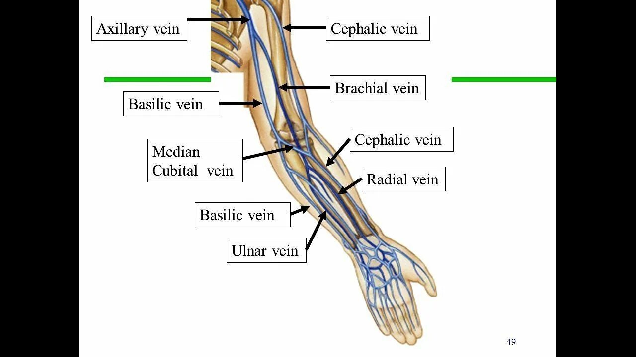 Склеротерапия сосудистых звездочек. Upper extremity veins. Good vein. Бедренная вена анатомия. Cefalica латеральная подкожная вена.