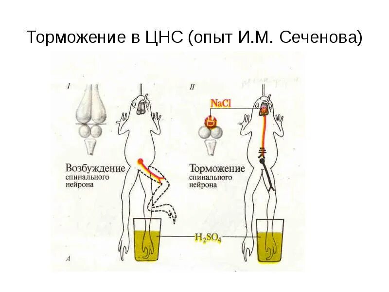 Опыт Сеченова торможение в ЦНС схема. Опыт Сеченова с лягушкой центральное торможение. Опыт Сеченова торможение спинальных рефлексов. «Центральное торможение (опыт и.м. Сеченова).