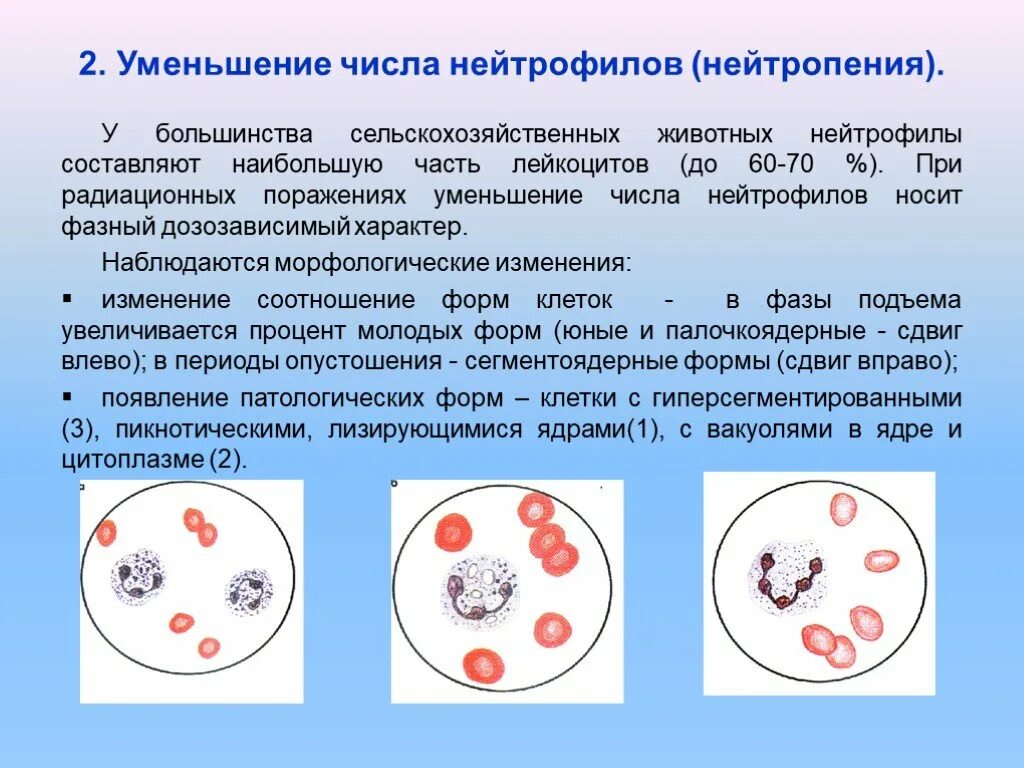 Нейтрофилы понижены. Снижение нейтрофилов. Снижение количества нейтрофилов. Снижение сегментоядерных нейтрофилов. Уменьшение сегментоядерных нейтрофилов в крови.