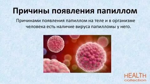 Вирус папилломы гинекология как передается
