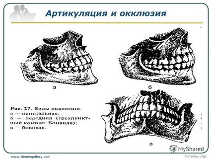 Прикус виды прикуса артикуляция