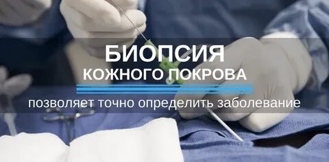 Анализ на псориаз