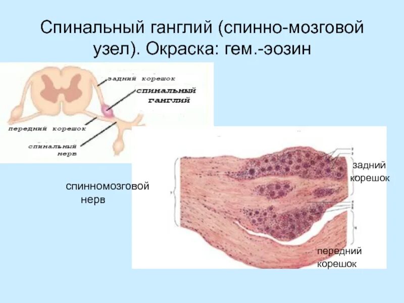 Клетки спинномозгового узла. Строение спинального ганглия. Спинномозговой ганглий гистология. Спинальный ганглий гистология препарат. Спинномозговой ганглий функции гистология.