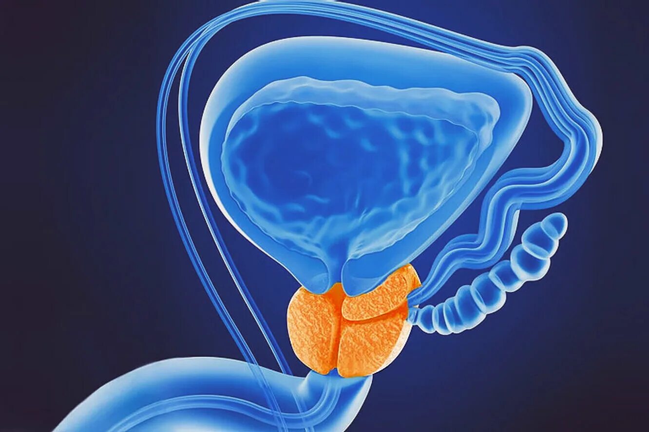 Простату телефон. Онкология предстательной железы. Предстательная железа 3d.