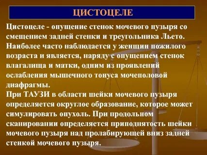 Что такое цистоцеле у женщин