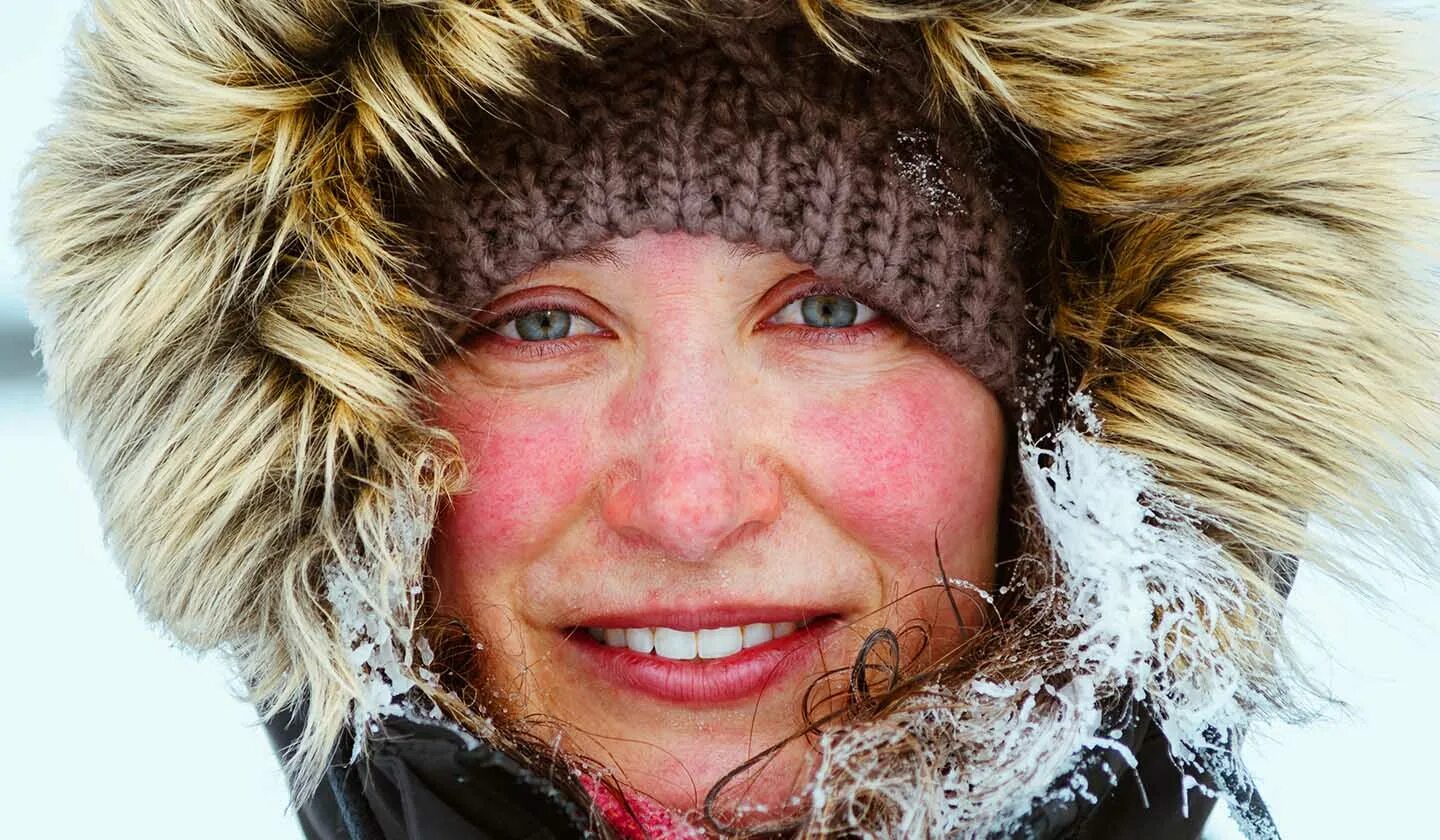 Cold лицо. Лицо на морозе. Румяная девушка. Красные щеки на морозе. Обветрилось лицо на морозе.