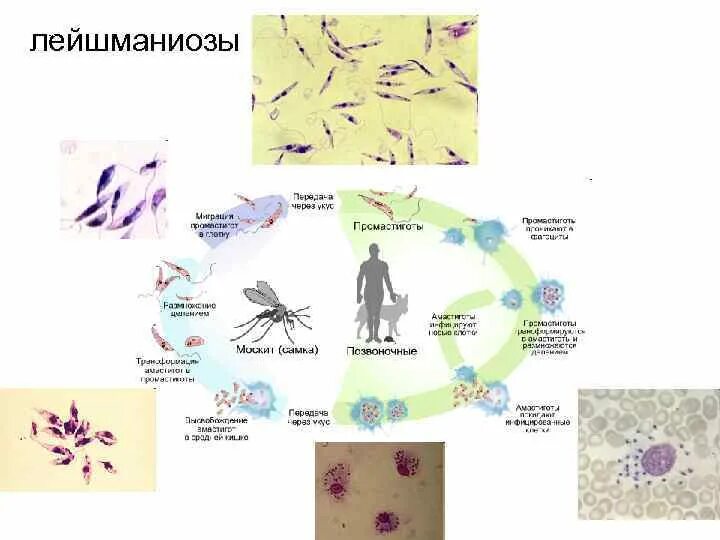 Инвазионная стадия лейшмании. Лейшмания жизненный цикл. жизненный цикл лейшмании схема. кожный лейшманиоз патогенез. лейшмания тропика жизненный цикл.