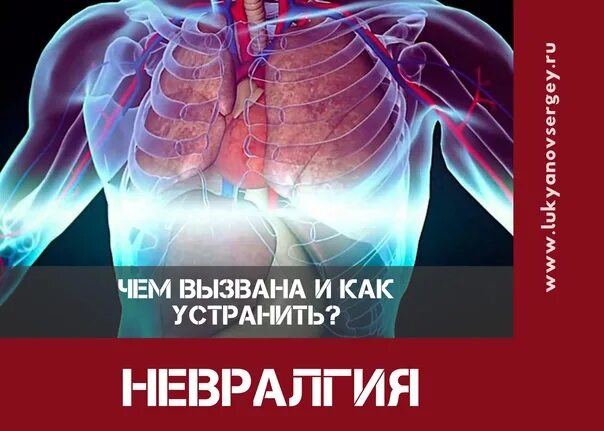 Как лечить межреберную невралгию слева под ребрами