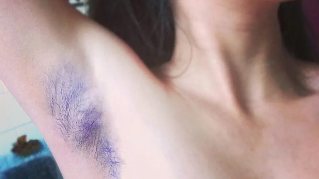 Небритые подмышки. Подмышки тёмные женские. Подмышки до и после лазерной эпиляции. Небритые женские подмышки. Лез подмышки.