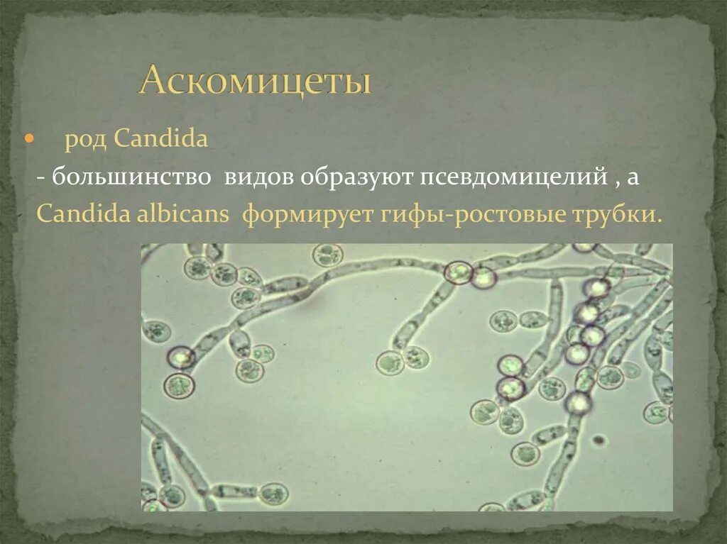 Оборудование для изучения клеток дрожжевых грибов. Candida дрожжевые клетки псевдомицелий. Дрожжеподобные грибы: псевдомицелий. Candida albicans псевдомицелий. Бластоспоры кандида.