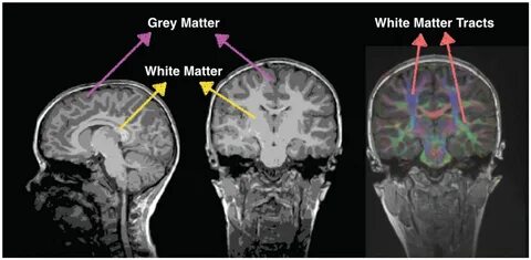 White matter