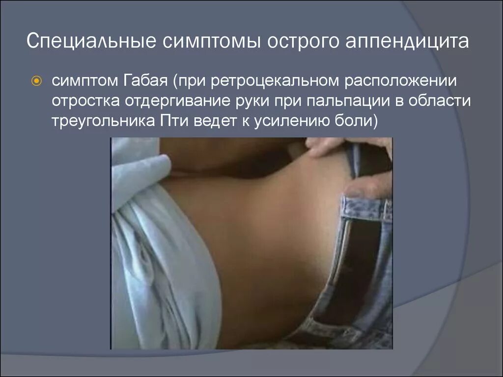 Как определить приступ аппендицита. Признаки острого аппендицита. Основные симптомы аппендицита. Симптомы при аппендиците у взрослых женщин. Острый аппендицит тазовое расположение.