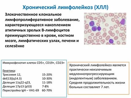 Хроническая лимфома