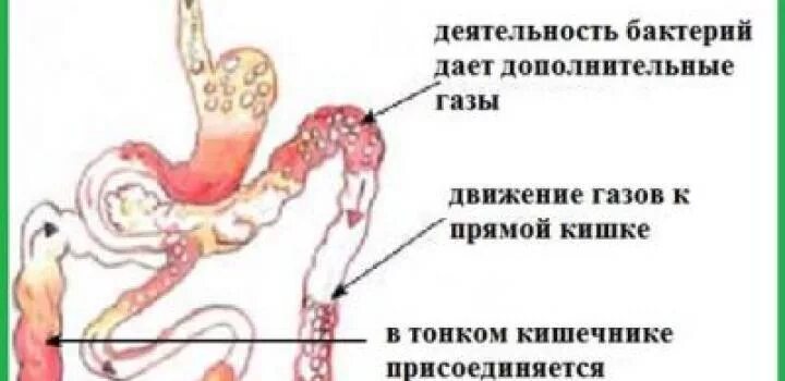 Частые пуки. Образование газов в кишечнике.