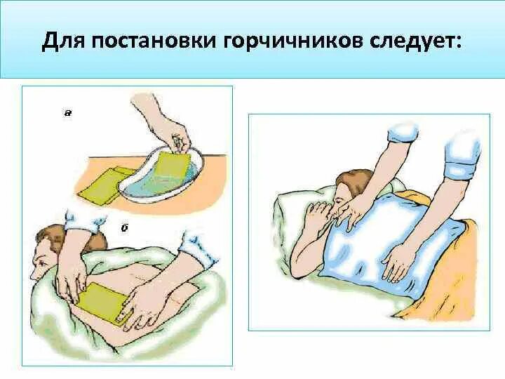 Температура воды для смачивания горчичников. Постановка горчичников алгоритм. Памятка постановка горчичников. Техника постановки горчичников алгоритм. Постановка компрессов, грелок, горчичников.