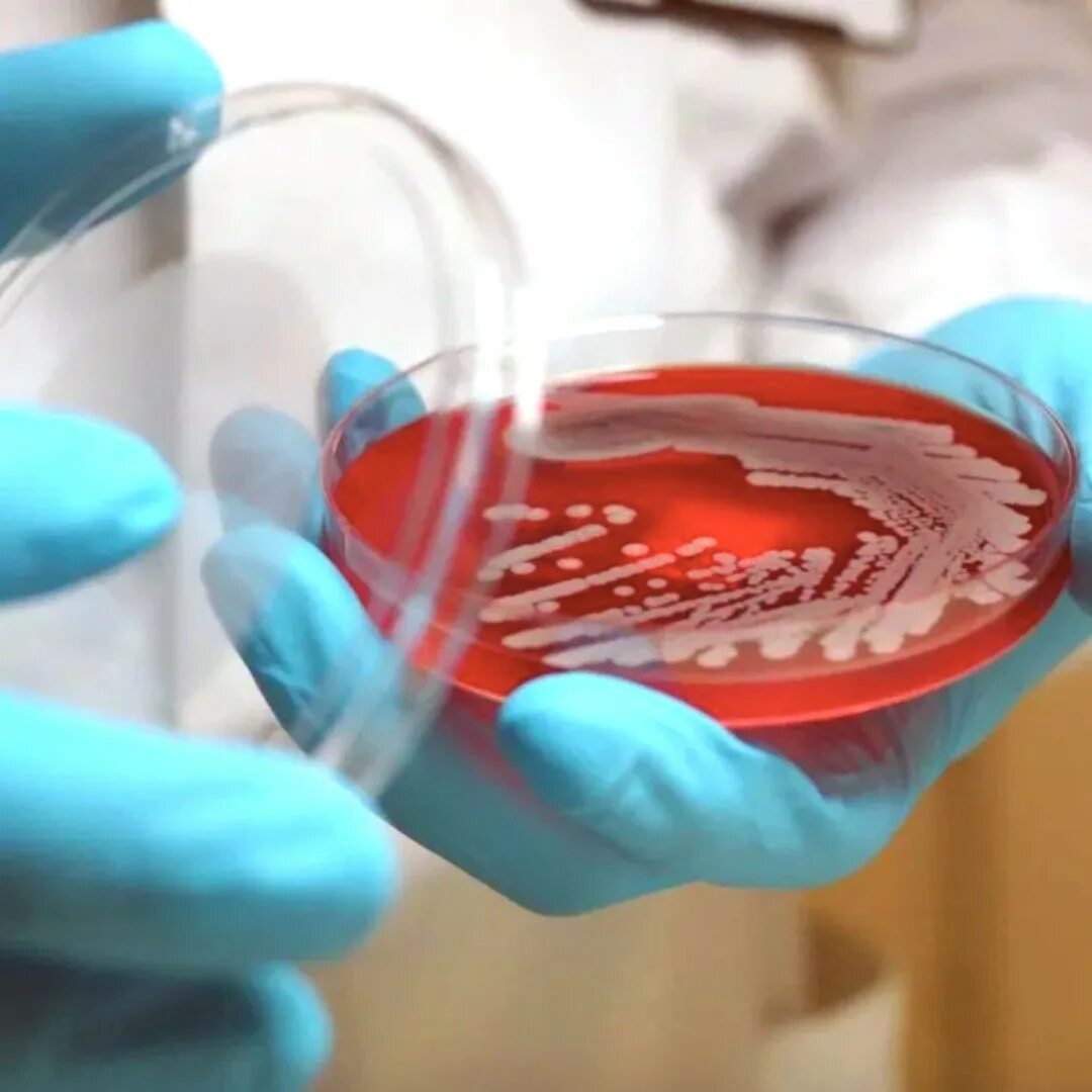 Исследование крови на стерильность микробиология. Бактериологический посев. Кровь бактериологическая. Забор крови на микробиологическое исследование.