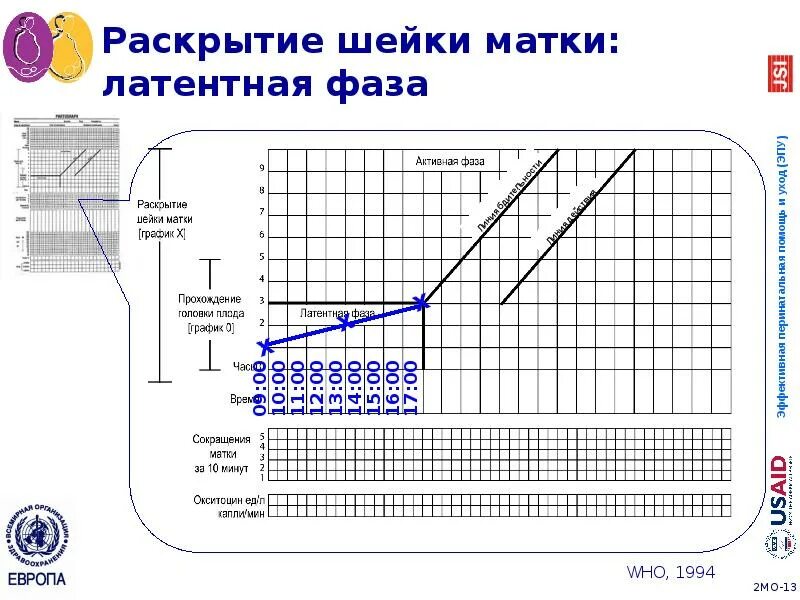 Латентная фаза родов. Партограмма латентная фаза. Партограмма в акушерстве образец. Партограмма в акушерстве норма. Партограмма состояние плода.