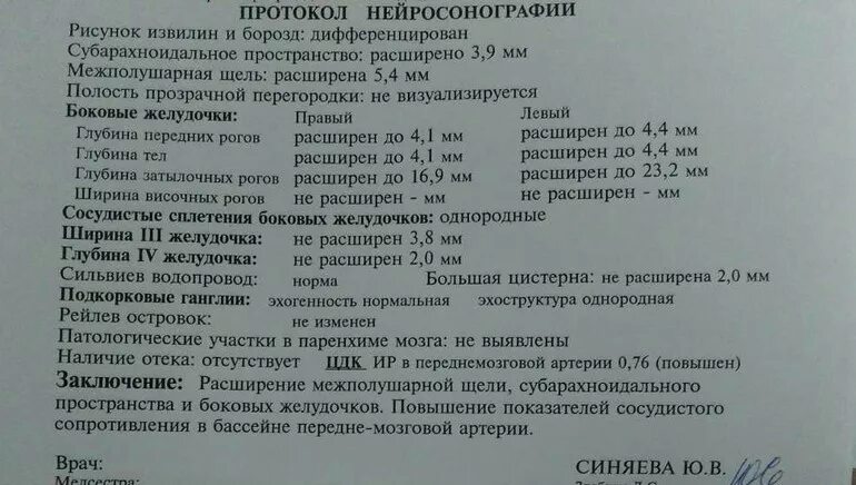 Расширение рогов боковых желудочков. Нейросонография головного мозга грудничка норма. УЗИ головного мозга у новорожденных расшифровка норма таблица. УЗИ головного мозга 1 месяц показатели норма. УЗИ головного мозга у новорожденных норма таблица.