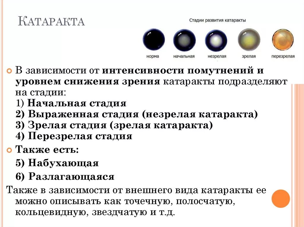 На начальных этапах хорошо. Катаракта классификация по стадиям. Стадии развития возрастной катаракты. Катаракта начальная стадия. Катаракта по степени помутнений.