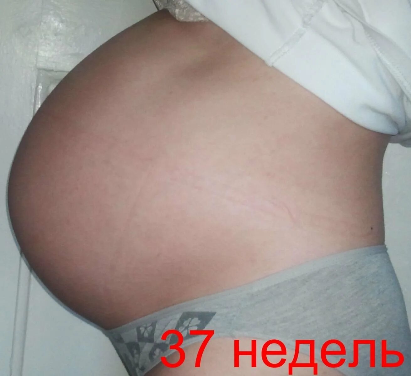 Скоро 37 неделя беременности. Ребёнок на 37 неделе беременности. живот при маловодии. живот беременной при маловодии.