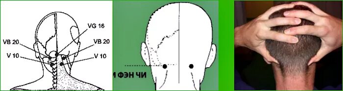 Две точки на шее. Точка vb20 - фэн-чи. точка на затылке у основания черепа. точки в основании черепа от головной боли. массажные точки на основании черепа.