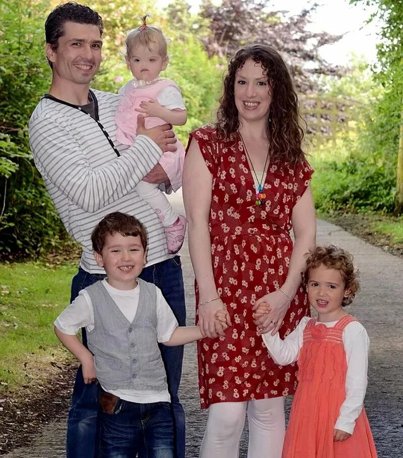 Тесса эванс после операции. Тесса эванс после операции. Тесса эванс. Девочка без носа тесса эванс. Тесса эванс.