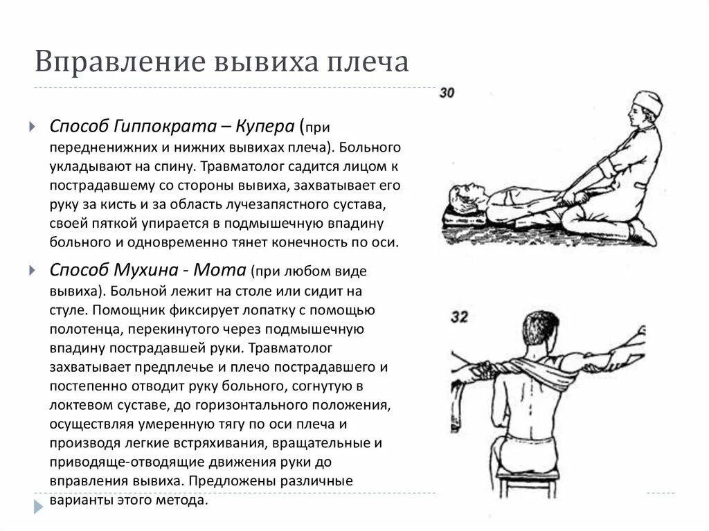 Как исправить вывих. Наиболее распространенные способы вправления вывихов плеча.. методы вправления вывиха плеча. методы вправления вывиха купера. способ мухина мота вправление вывиха плеча.